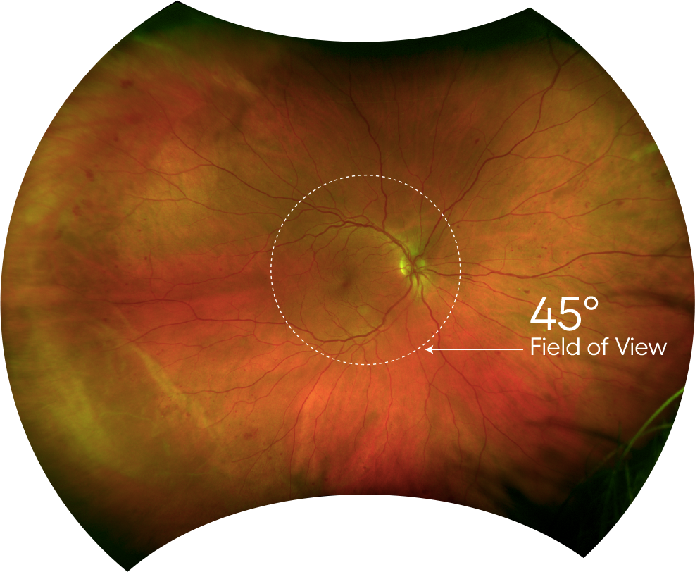Retinal imaging technology demonstration